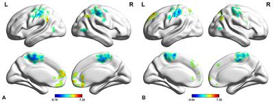 Recursive Partitioning Analysis of Fractional Low-Frequency Fluctuations in Narcolepsy With Cataplexy